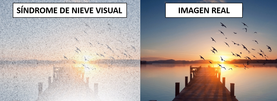 Diferencia en una foto de un atardecer entre ver normal y con el síndrome de nieve visual