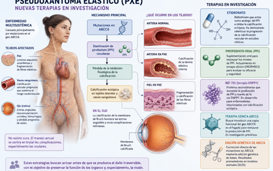 Nuevas terapias en investigación para el pseudoxantoma elástico (PXE)