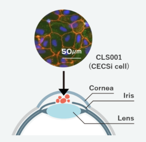 En la imagen se puede ver como se hace un trasplante alogénico de células CLS001