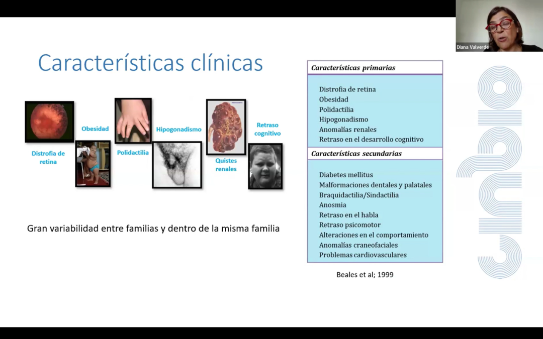 Ya disponible la grabación del webinar: «Síndrome de Bardet-Biedl: Entender la enfermedad y los avances médicos»